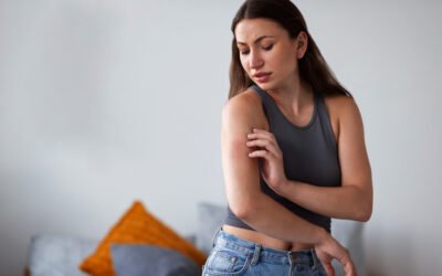 Top Skin Allergies and How to Manage Them Before They Get Worse