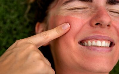 PMLE Explained: Why Some People Are ‘Allergic’ to the April Sun