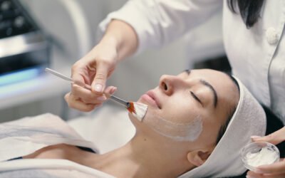 Chemical Peels for Sensitive Skin: What to Know Before Your Appointment